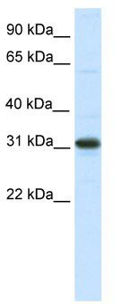 WB Suggested Anti-NRIP2 Antibody Titration: 0.125 ug/ml; ELISA Titer: 1:312500; Positive Control: Human Cerebellum