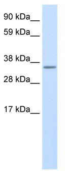 WB Suggested Anti-Use1 Antibody Titration: 0.2-1 ug/ml; ELISA Titer: 1:62500; Positive Control: SP2/0 cell lysate