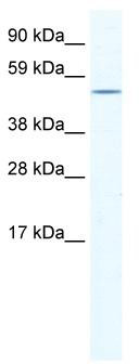 WB Suggested Anti-NR5A1 Antibody Titration: 0.3125 ug/ml; ELISA Titer: 1:312500; Positive Control: Human Adrenal gland