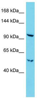 Host: Rabbit; Target Name: Radil; Sample Tissue: Mouse Lung lysates; Antibody Dilution: 1.0ug/ml