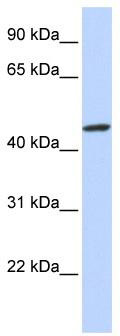 WB Suggested Anti-ZNF239 Antibody Titration: 0.2-1 ug/ml; ELISA Titer: 1: 1562500; Positive Control: Human brain