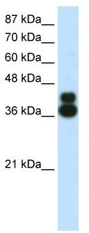 WB Suggested Anti-FOXJ1 Antibody Titration: 0.2-1 ug/ml; ELISA Titer: 1: 500; Positive Control: HepG2 cell lysate
