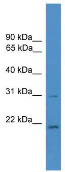 WB Suggested Anti-HOXB1 Antibody Titration: 0.2-1 ug/ml; ELISA Titer: 1: 62500; Positive Control: MCF7 cell lysate