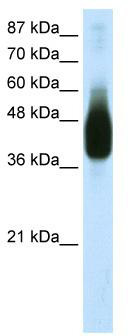WB Suggested Anti-JUNB Antibody Titration: 1.25 ug/ml; ELISA Titer: 1: 1562500; Positive Control: Transfected 293T