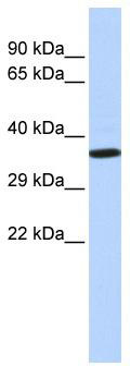 WB Suggested Anti-NKX2-2 Antibody Titration: 0.2-1 ug/ml; ELISA Titer: 1: 1562500; Positive Control: Human Placenta