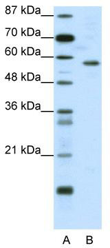 WB Suggested Anti-YY1 Antibody Titration: 0.2-1 ug/ml; ELISA Titer: 1: 62500; Positive Control: Jurkat cell lysate; There is BioGPS gene expression data showing that YY1 is expressed in Jurkat