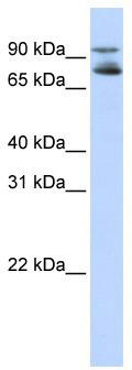 WB Suggested Anti-FOXK2 Antibody Titration: 0.2-1 ug/ml; ELISA Titer: 1: 62500; Positive Control: HepG2 cell lysate; FOXK2 is supported by BioGPS gene expression data to be expressed in HepG2
