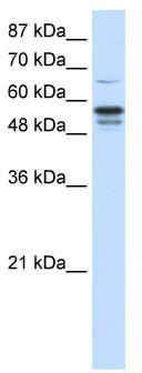 WB Suggested Anti-FOXG1B Antibody Titration: 1.25 ug/ml; Positive Control: HepG2 cell lysate