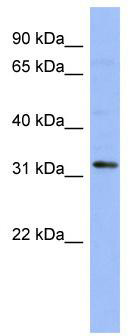 WB Suggested Anti-TLX1 Antibody Titration: 0.2-1 ug/ml; ELISA Titer: 1: 1562500; Positive Control: 721_B cell lysate; TLX1 is supported by BioGPS gene expression data to be expressed in 721_B