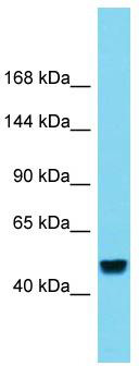 Host: Rabbit; Target Name: RBL2; Sample Tissue: Liver Tumor lysates; Antibody Dilution: 1.0 ug/ml