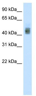 WB Suggested Anti-SOX3 Antibody Titration: 1.25 ug/ml; ELISA Titer: 1: 1562500; Positive Control: MCF7 cell lysateSOX3 is supported by BioGPS gene expression data to be expressed in MCF7