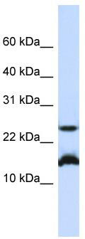 WB Suggested Anti-BATF Antibody Titration: 0.2-1 ug/ml; ELISA Titer: 1: 312500; Positive Control: Jurkat cell lysate; BATF is supported by BioGPS gene expression data to be expressed in Jurkat