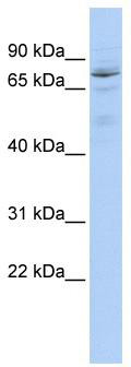 WB Suggested Anti-HIC1 Antibody Titration: 0.2-1 ug/ml; ELISA Titer: 1: 1562500; Positive Control: 721_B cell lysate.HIC1 is supported by BioGPS gene expression data to be expressed in 721_B