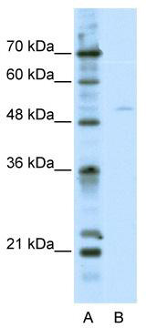 WB Suggested Anti-TFEB Antibody Titration: 2.5 ug/ml; ELISA Titer: 1: 312500; Positive Control: HepG2 cell lysate