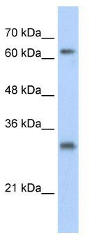 WB Suggested Anti-USP39 Antibody Titration: 0.2-1 ug/ml; Positive Control: HepG2 cell lysate. USP39 is supported by BioGPS gene expression data to be expressed in HepG2