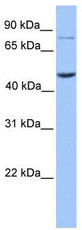 WB Suggested Anti-ZBTB6 Antibody Titration: 0.2-1 ug/ml; Positive Control: Hela cell lysate