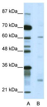 WB Suggested Anti-NR1I2 Antibody Titration: 5.0 ug/ml; ELISA Titer: 1: 12500; Positive Control: Jurkat cell lysate