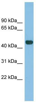 WB Suggested Anti-TFB2M Antibody Titration: 0.2-1 ug/ml; ELISA Titer: 1: 62500; Positive Control: Human Spleen