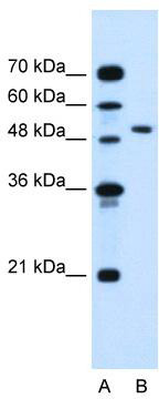 WB Suggested Anti-NR1I2 Antibody Titration: 0.5 ug/ml; Positive Control: Jurkat cell lysate