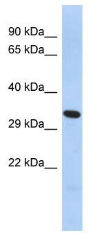 WB Suggested Anti-FOXK2 Antibody Titration: 0.2-1 ug/ml; ELISA Titer: 1: 312500; Positive Control: THP-1 cell lysate