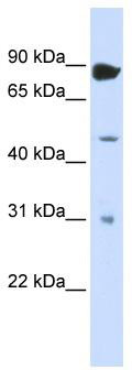WB Suggested Anti-ADARB1 Antibody Titration: 0.2-1 ug/ml; ELISA Titer: 1: 1562500; Positive Control: Transfected 293T