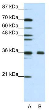 WB Suggested Anti-FBL Antibody Titration: 1.25 ug/ml; ELISA Titer: 1: 12500; Positive Control: Jurkat cell lysate; FBL is supported by BioGPS gene expression data to be expressed in Jurkat