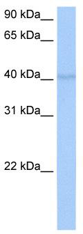 WB Suggested Anti-RBM4 Antibody Titration: 0.2-1 ug/ml; Positive Control: MCF7 cell lysate; RBM4 is strongly supported by BioGPS gene expression data to be expressed in Human MCF7 cells