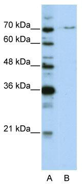 WB Suggested Anti-PRPF3 Antibody Titration: 0.2-1 ug/ml; ELISA Titer: 1: 62500; Positive Control: HepG2 cell lysate
