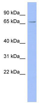 WB Suggested Anti-RAVER2 Antibody Titration: 0.2-1 ug/ml; ELISA Titer: 1: 62500; Positive Control: HT1080 cell lysate