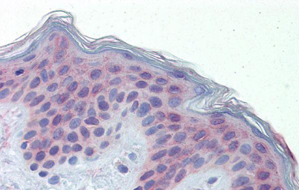 Human Skin