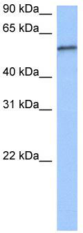WB Suggested Anti-RPUSD2 Antibody Titration: 0.2-1 ug/ml; Positive Control: Jurkat cell lysate; RPUSD2 is supported by BioGPS gene expression data to be expressed in Jurkat
