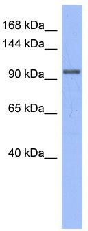 WB Suggested Anti-MSH4 Antibody Titration: 0.2-1 ug/ml; ELISA Titer: 1: 62500; Positive Control: PANC1 cell lysateMSH4 is supported by BioGPS gene expression data to be expressed in PANC1