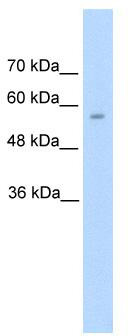 WB Suggested Anti-DDC Antibody Titration: 5.0 ug/ml; Positive Control: HepG2 cell lysateDDC is supported by BioGPS gene expression data to be expressed in HepG2