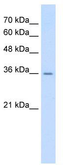 WB Suggested Anti-AGER Antibody Titration: 0.2-1 ug/ml; Positive Control: HepG2 cell lysate