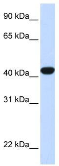 WB Suggested Anti-FAH Antibody Titration: 0.2-1 ug/ml; ELISA Titer: 1: 62500; Positive Control: Human Liver