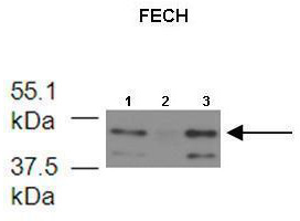 Lanes: 1. 6 ug mouse brain mitochondria extract 2. 6 ug mouse brain mitochondria extract 3. 6 ug mouse brain mitochondria extract; Primary Antibody Dilution: 1: 500; Secondary Antibody: Anti-rabbit HRP; Secondary Antibody Dilution: 1: 3000; Gene Name: FECH; Submitted by: Dr. Hao Zhu, University of Kansas Medical Center;