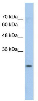 WB Suggested Anti-GSTM1 Antibody Titration: 0.2-1 ug/ml; Positive Control: Jurkat cell lysate