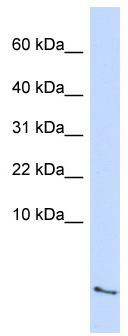 WB Suggested Anti-SAA4 Antibody Titration: 0.2-1 ug/ml; ELISA Titer: 1: 62500; Positive Control: Human Lung