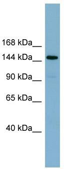 WB Suggested Anti-KIAA1199 Antibody Titration: 0.2-1 ug/ml; Positive Control: COLO205 cell lysate; KIAA1199 is supported by BioGPS gene expression data to be expressed in COLO205