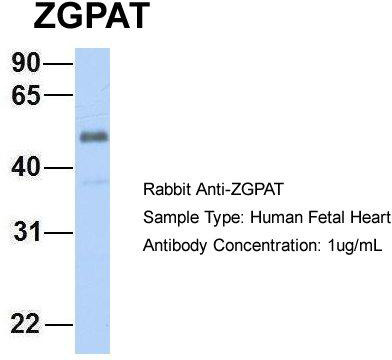 Host: Rabbit; Target Name: ZGPAT; Sample Tissue: Human Fetal Heart; Antibody Dilution: 1.0ug/ml