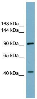 WB Suggested Anti-ITCH Antibody Titration: 0.2-1 ug/ml; ELISA Titer: 1:312500; Positive Control: COLO205 cell lysate