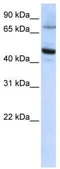 WB Suggested Anti-CYP46A1 Antibody Titration: 0.2-1 ug/ml; ELISA Titer: 1: 312500; Positive Control: HepG2 cell lysate
