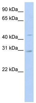 WB Suggested Anti-SLC10A4 Antibody Titration: 0.2-1 ug/ml; ELISA Titer: 1:312500; Positive Control: 721_B cell lysate