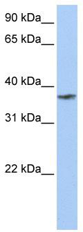 WB Suggested Anti-TMCC1 Antibody Titration: 0.2-1 ug/ml; Positive Control: Human Muscle