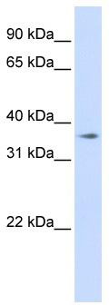 WB Suggested Anti-TMEM30B Antibody Titration: 0.2-1 ug/ml; ELISA Titer: 1: 312500; Positive Control: 293T cell lysate