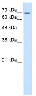 WB Suggested Anti-USP48 Antibody Titration: 0.2-1 ug/ml; Positive Control: HepG2 cell lysate;USP48 is strongly supported by BioGPS gene expression data to be expressed in Human HepG2 cells