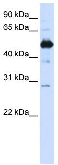 WB Suggested Anti-FAM134B Antibody Titration: 0.2-1 ug/ml; ELISA Titer: 1: 62500; Positive Control: Transfected 293T