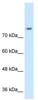 WB Suggested Anti-NRCAM Antibody Titration: 0.2-1 ug/ml; Positive Control: Jurkat cell lysate