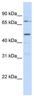 WB Suggested Anti-KREMEN1 Antibody Titration: 0.2-1 ug/ml; ELISA Titer: 1: 62500; Positive Control: MCF7 cell lysate