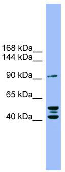 WB Suggested Anti-ENPP2 Antibody Titration: 0.2-1 ug/ml; ELISA Titer: 1: 1562500; Positive Control: COLO205 cell lysate